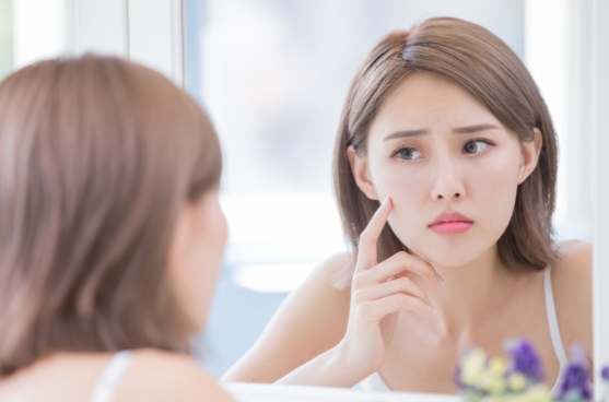 杜鵑花酸痘痘 杜鵑花酸痘痘