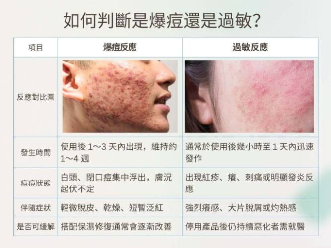 杜鵑花酸爆痘時間 杜鵑花酸爆痘時間