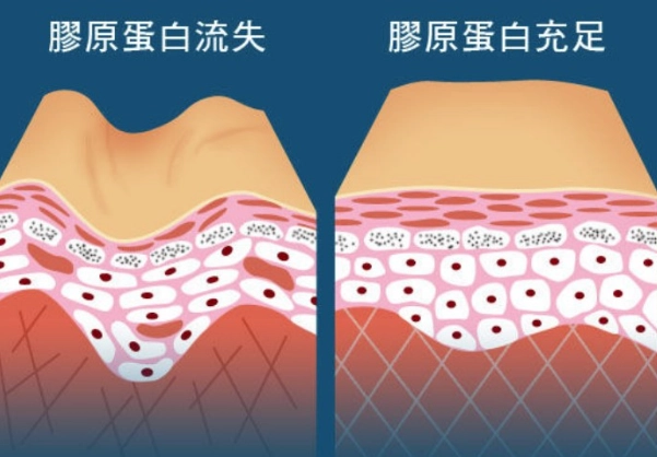 膠原蛋白保養品