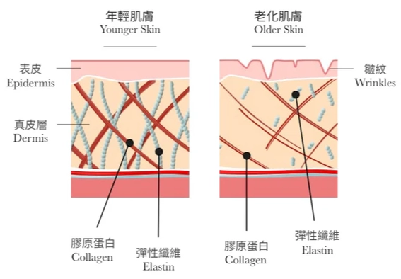 皮膚膠原蛋白流失