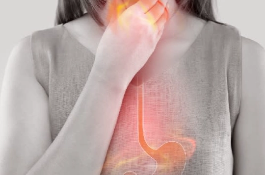 中醫治胃食道逆流