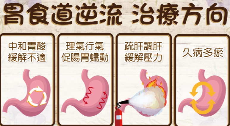 胃食道逆流中醫治療