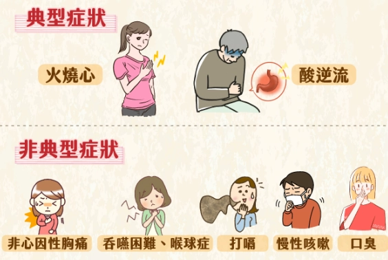 胃食道逆流中醫治療