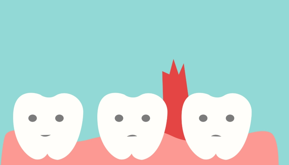 牙齦保健方法 牙齦保健方法