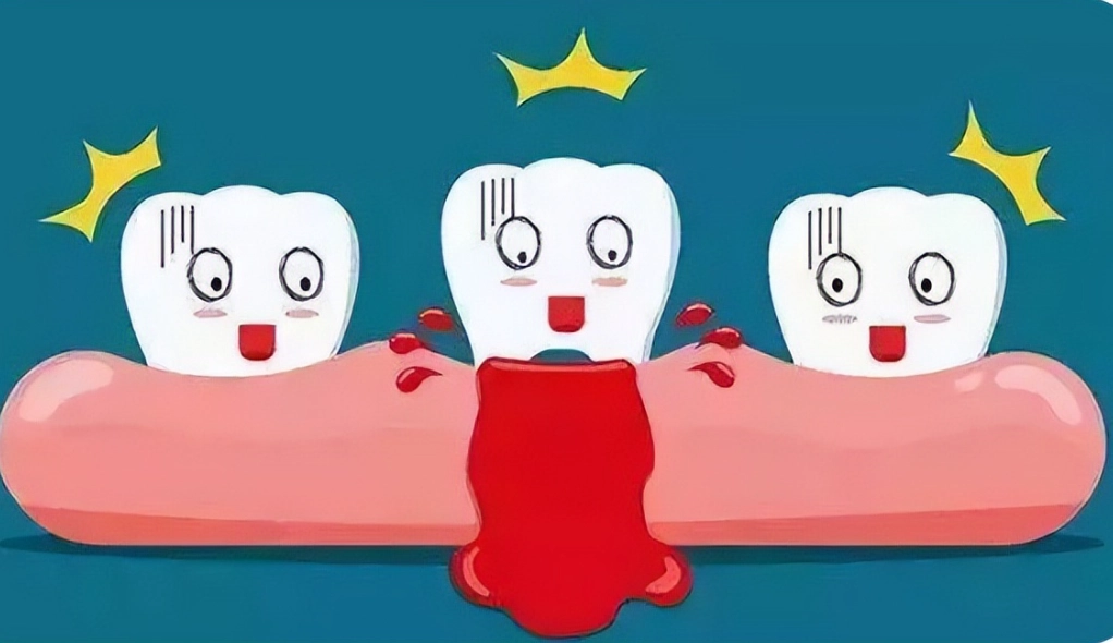 牙齦出血牙膏