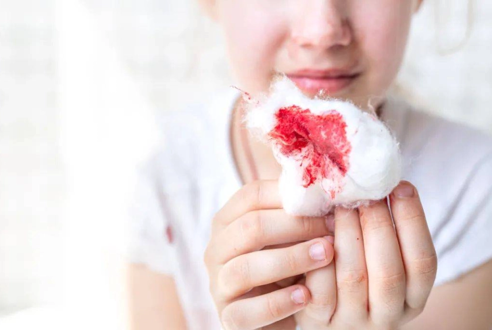 牙齦保健方法 牙齦保健方法