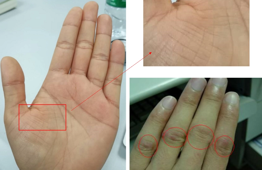 居家足部護理 居家足部護理