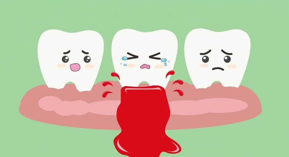 牙齦出血原因 牙齦出血原因