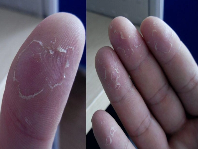 凡士林 手部護理